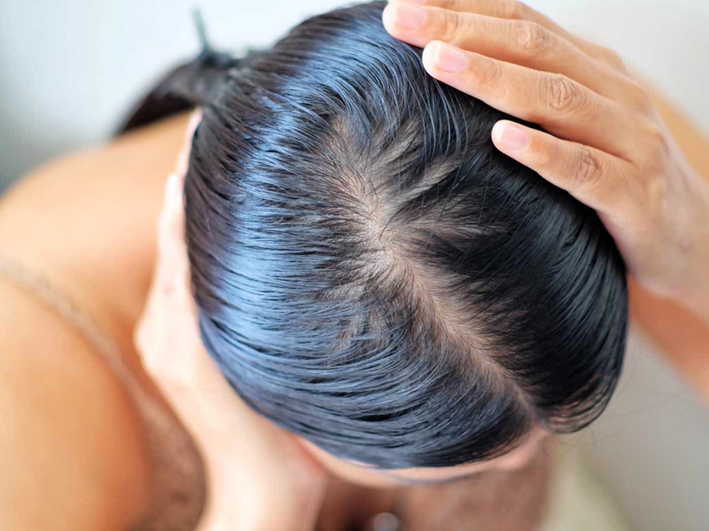 how to reduce sebum production on scalp