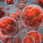 Dynamic Stem Cell Therapy: Alternative Treatments for Meniscus Tears