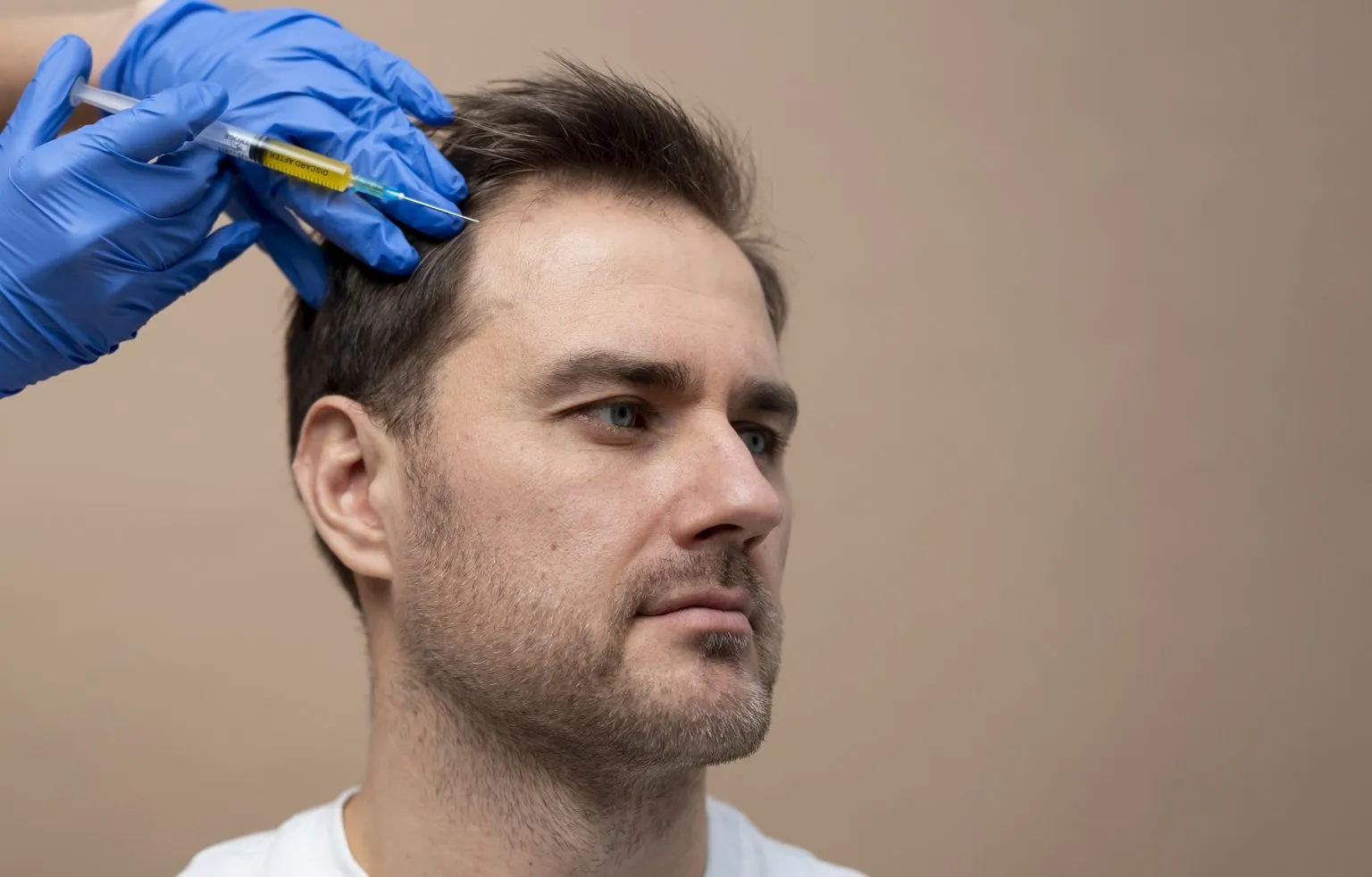 hair transplant procedure