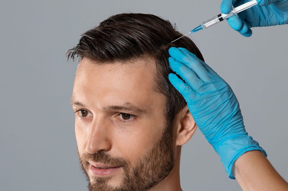 micro needling for hair loss 960x636 1